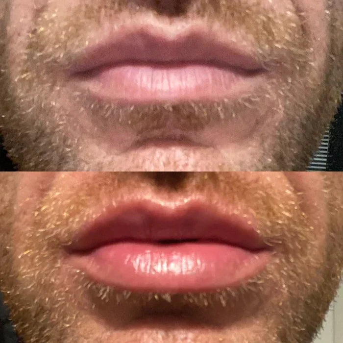 Rapid Lip Plumping Serum