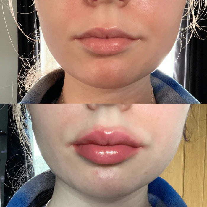 Rapid Lip Plumping Serum