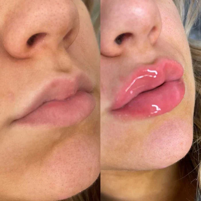 Rapid Lip Plumping Serum