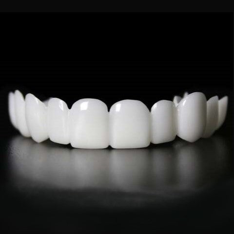 Snap-On Veneers for Upper and Lower Teeth for an Instant Natural Smile