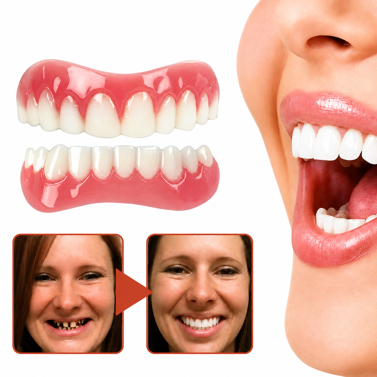 Dental Prosthesis | Soft Silicone Cushion | Non-Slip Fit Without Pressure Points