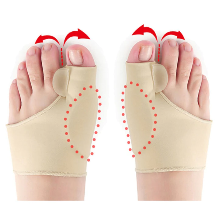 Gel Hallux Valgus Corrector – Enhanced Comfort and Support
